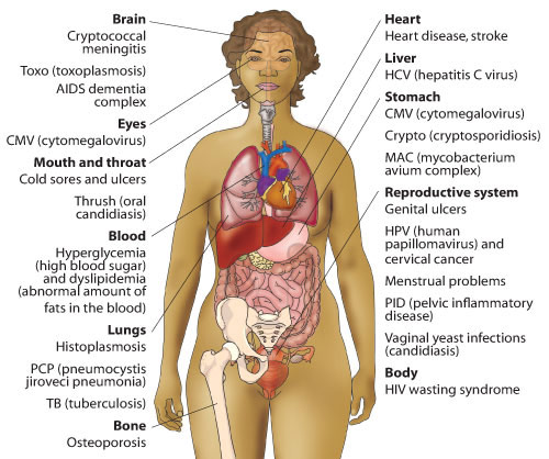 hiv-infections-diagram.jpg